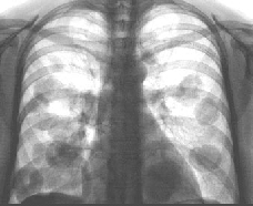röntgenbild
