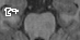 Image T1_8607_r_hippo_cut_ax_s7