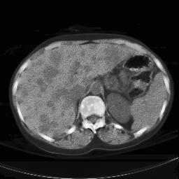 Image liver_loc_eq