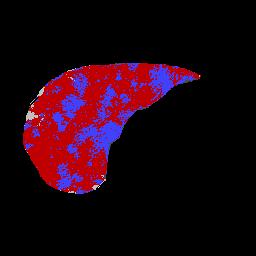 Image liver_seg