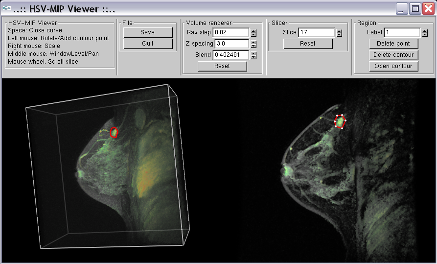 Image dynamicmipscreenshot