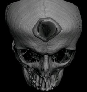 Image skull1