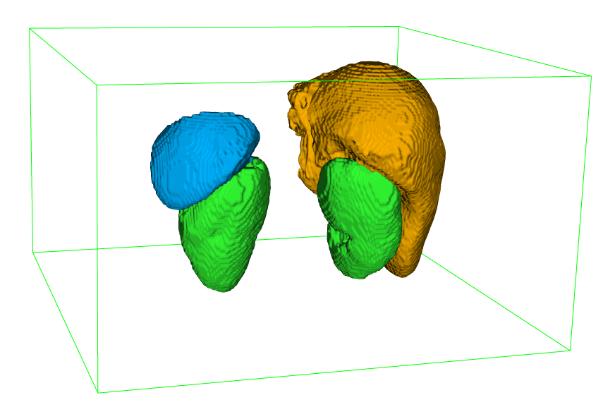 Image segmented_organs