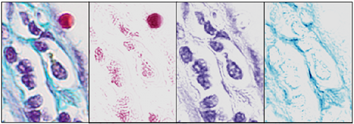 Image prostateOLD