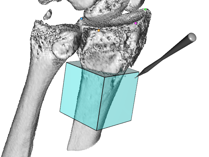 Image wrist_angle_measurements_subfigure_right