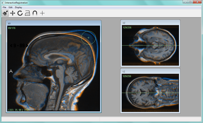 Image interactive_image_registration