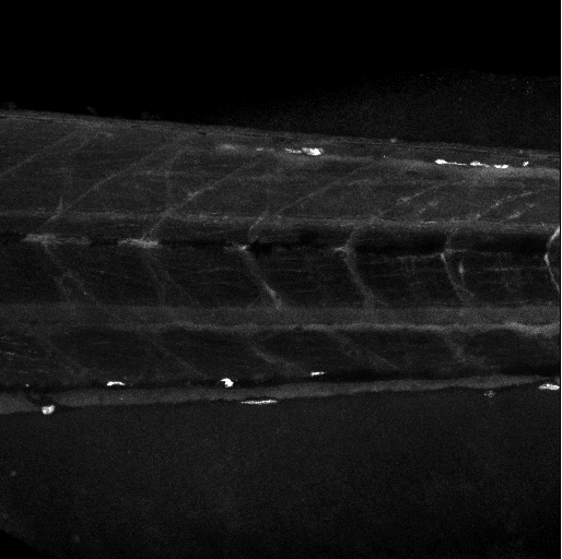 Image lipid1