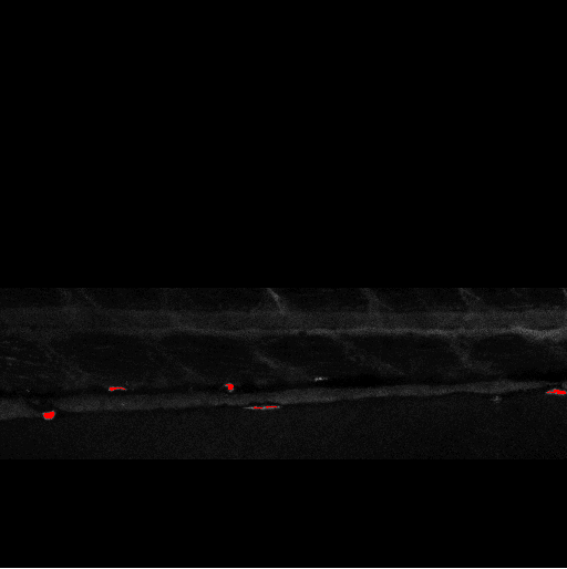 Image lipid2