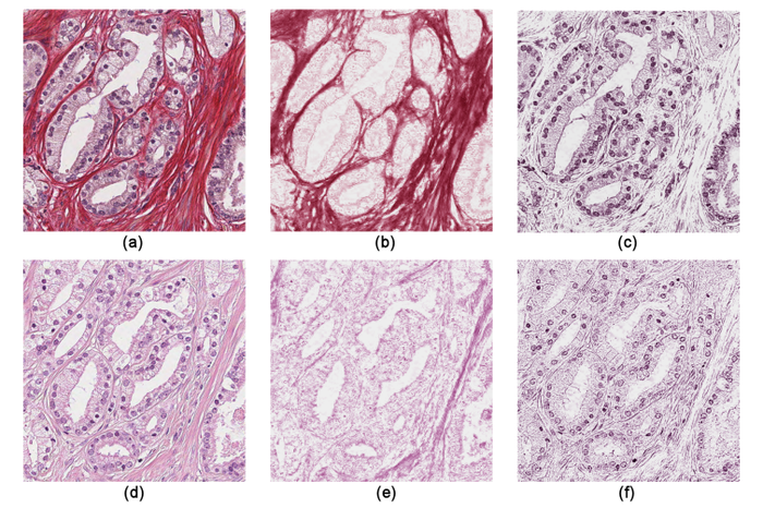 Image prostate2