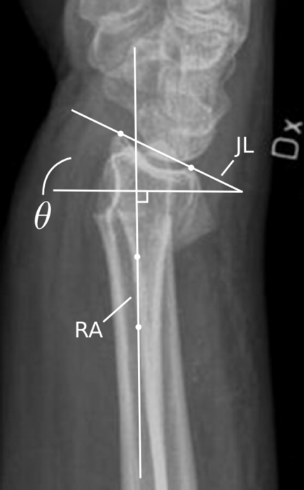 Image wrist_project_figure1a