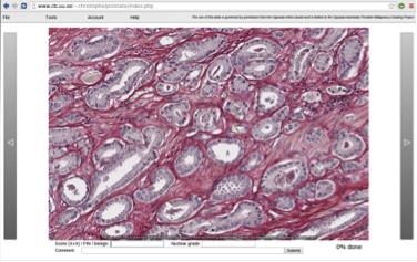 Image userinterfaceprostate