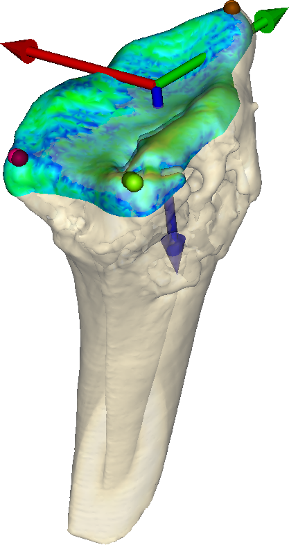 Image wrist_2014
