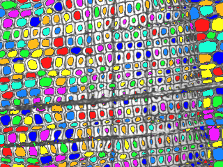 etiketterad fiberbild